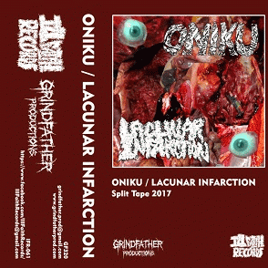 Oniku : Oniku - Lacunar Infarction